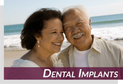 sunnyvale dental implant patients